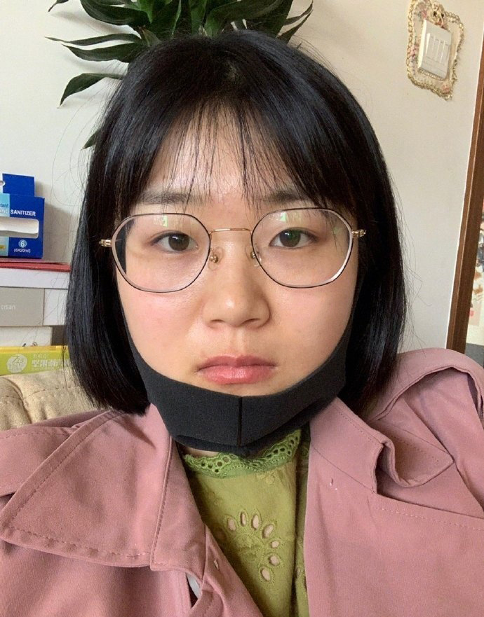 植題真實祛斑成功案例