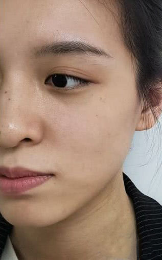 使用植题成功美白