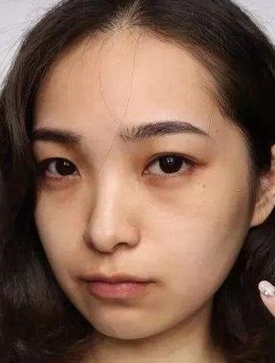 祛斑美白你可以永遠相信植題