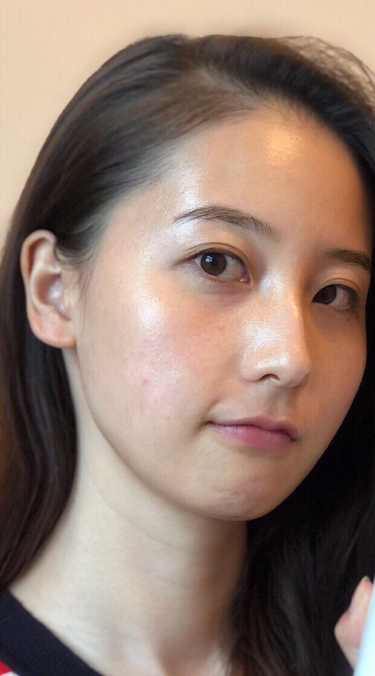 植题美白去暗黃不是夢